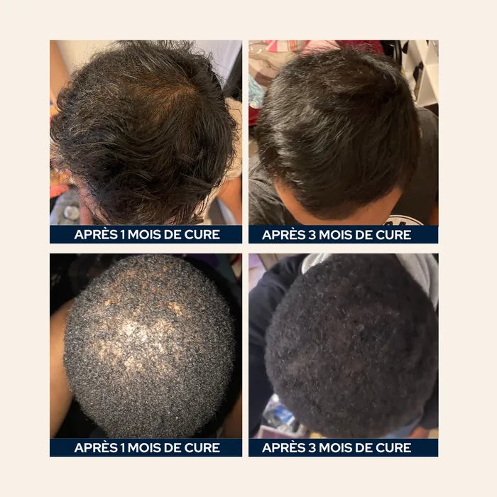 Gélules d'huile de pépins de courge